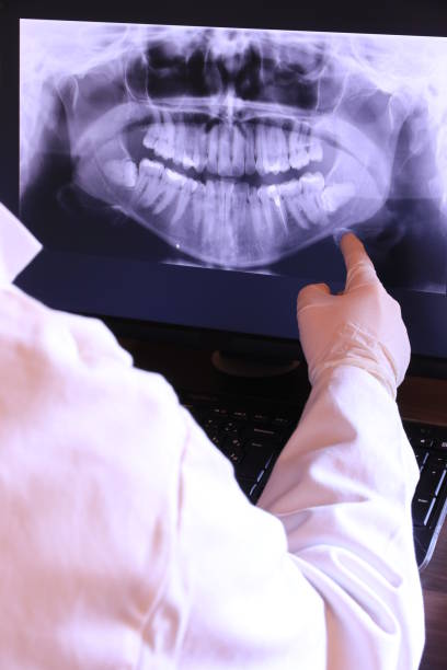Best Emergency Dentist for Lost Fillings or Crowns in Robie Creek, ID